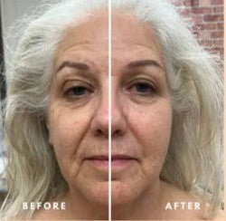 OnlyOnCart™ Lymphatic Face Brush